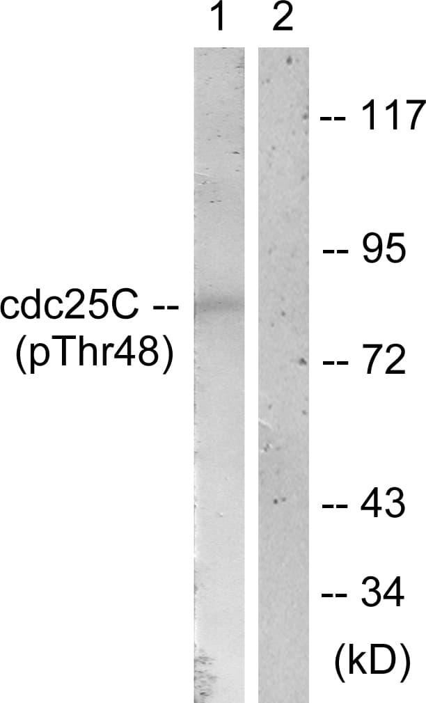 Polyclonal Rabbit anti-Human CDC25C Antibody (phospho-Thr48, IHC, WB)