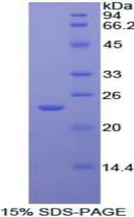 Mouse CASP9 / Caspase 9 Protein (Recombinant His)