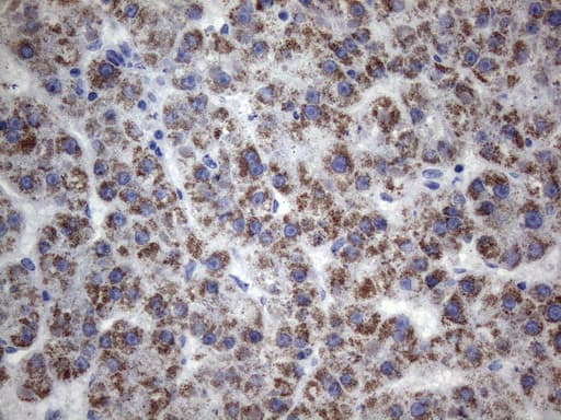 Monoclonal Mouse anti-Human TEM1 / CD248 Antibody (clone OTI1H6, aa20-300, IHC, WB)