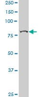 Monoclonal Mouse anti-Human CHUK / IKKA / IKK Alpha Antibody (clone 2G4, IF, WB)
