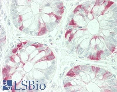 IHC-plus™ RRM2 Antibody