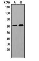 Polyclonal Rabbit anti-Human p66 / SHC Antibody (phospho-Tyr349, IHC, WB)