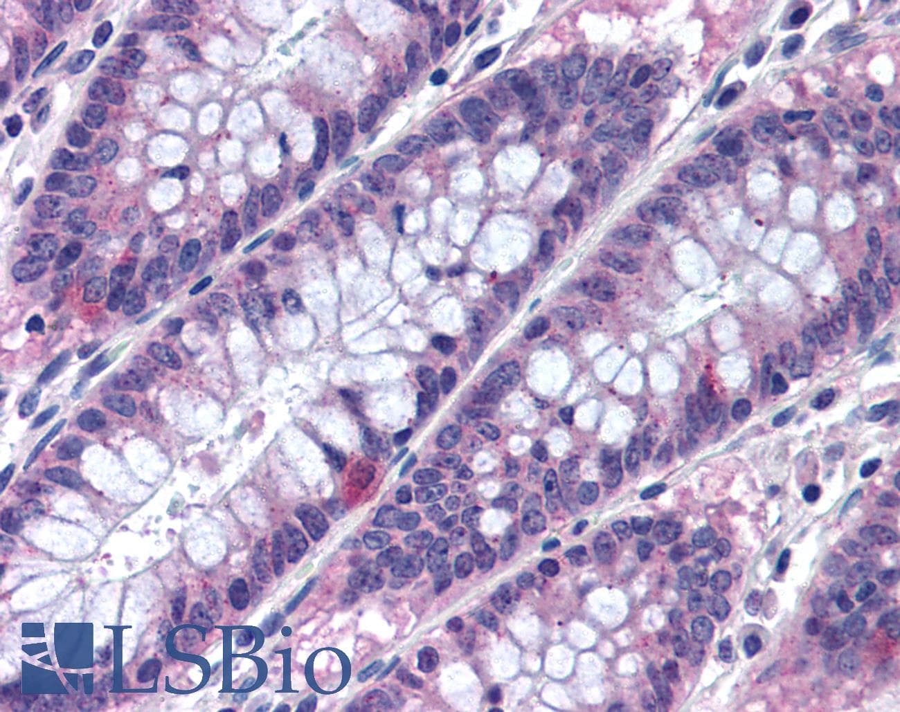 IHC-plus™ MTSS1 / MIM Antibody