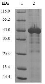 Human NAA50 / NAT13 / SAN Protein (Recombinant GST, N-terminus)