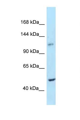 PPIP5K2 / HISPPD1 Antibody (aa914-963)