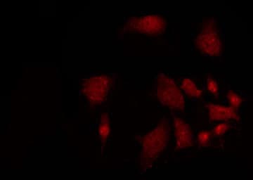 Polyclonal Rabbit anti-Human ARHGAP18 Antibody (IHC, IF, WB)