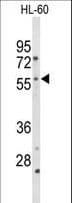 Polyclonal Rabbit anti-Human CYP2C19 Antibody (aa82-108, IHC, IF, WB)