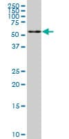 Monoclonal Mouse anti-Human FAAH Antibody (clone 2G8, WB)