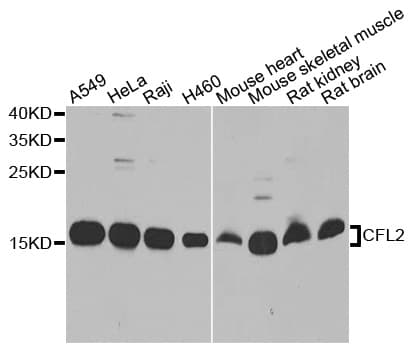 PathPlus™ Polyclonal Rabbit anti-Human CFL2 / Cofilin 2 Antibody (IHC, IF, WB)