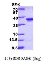 Human ARPC2 / p34-Arc Protein (Recombinant His)