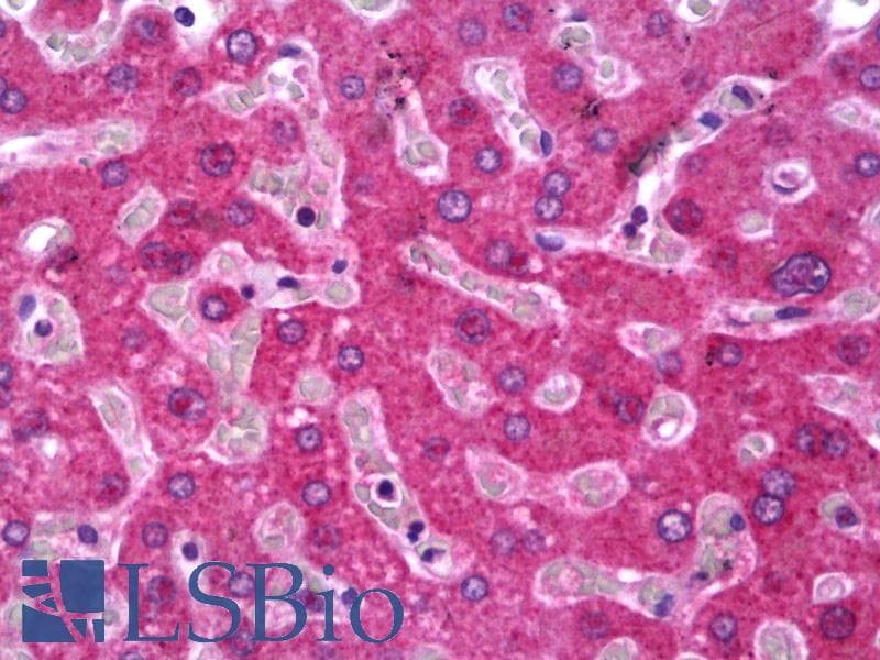 IHC-plus™ Polyclonal Rabbit anti-Human HPN / TMPRSS1 / Hepsin Antibody (IHC, WB)