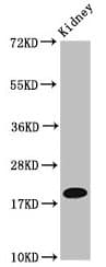 Polyclonal Rabbit anti-Human NAA38 / LSMD1 Antibody