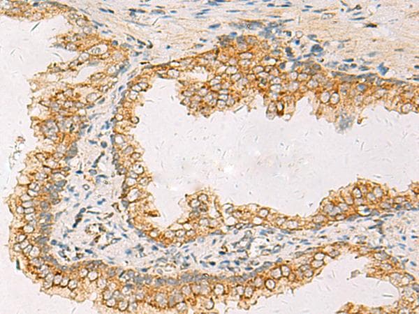 SUSD3 Antibody