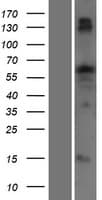 TTC22 Protein (Over-Expression Lysate Myc-DDK (Flag))