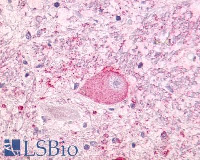 PathPlus™ NTSR1 / NTR Antibody (Cytoplasmic Domain)
