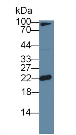 FTL / Ferritin Light Chain Antibody (aa5-183, PE)