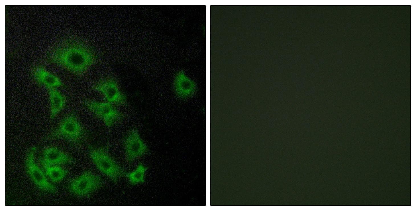 S1PR5 / EDG8 / S1P5 Antibody
