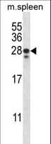 ANKRD22 Antibody (aa140-169)