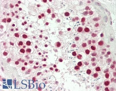 IHC-plus™ NUMA1 / NUMA Antibody (310-390 aa, N-terminal)