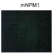 NPM1 / NPM / Nucleophosmin Antibody (C-Terminus, Biotin)