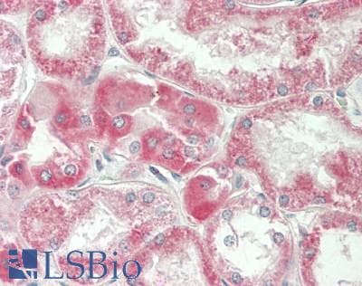 IHC-plus™ SLC36A2 Antibody