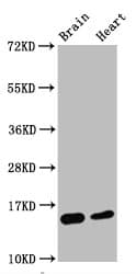 Recombinant Monoclonal Rabbit anti-Human HIST1H3A Antibody (IF, WB)