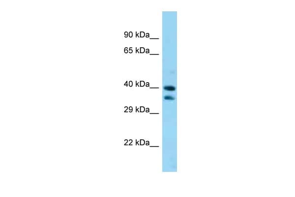 SAV1 / WW45 Antibody (aa266-315)