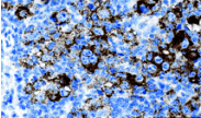 Monoclonal Mouse anti-Human GCET2 / HGAL Antibody (clone 1H1-A7, IHC, WB)