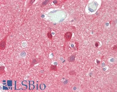IHC-plus™ Polyclonal Rabbit anti-Human KCNK9 / TASK3 Antibody (IHC, WB)