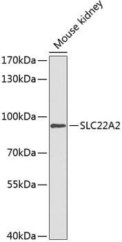 Polyclonal Rabbit anti-Human SLC22A2 Antibody (WB)