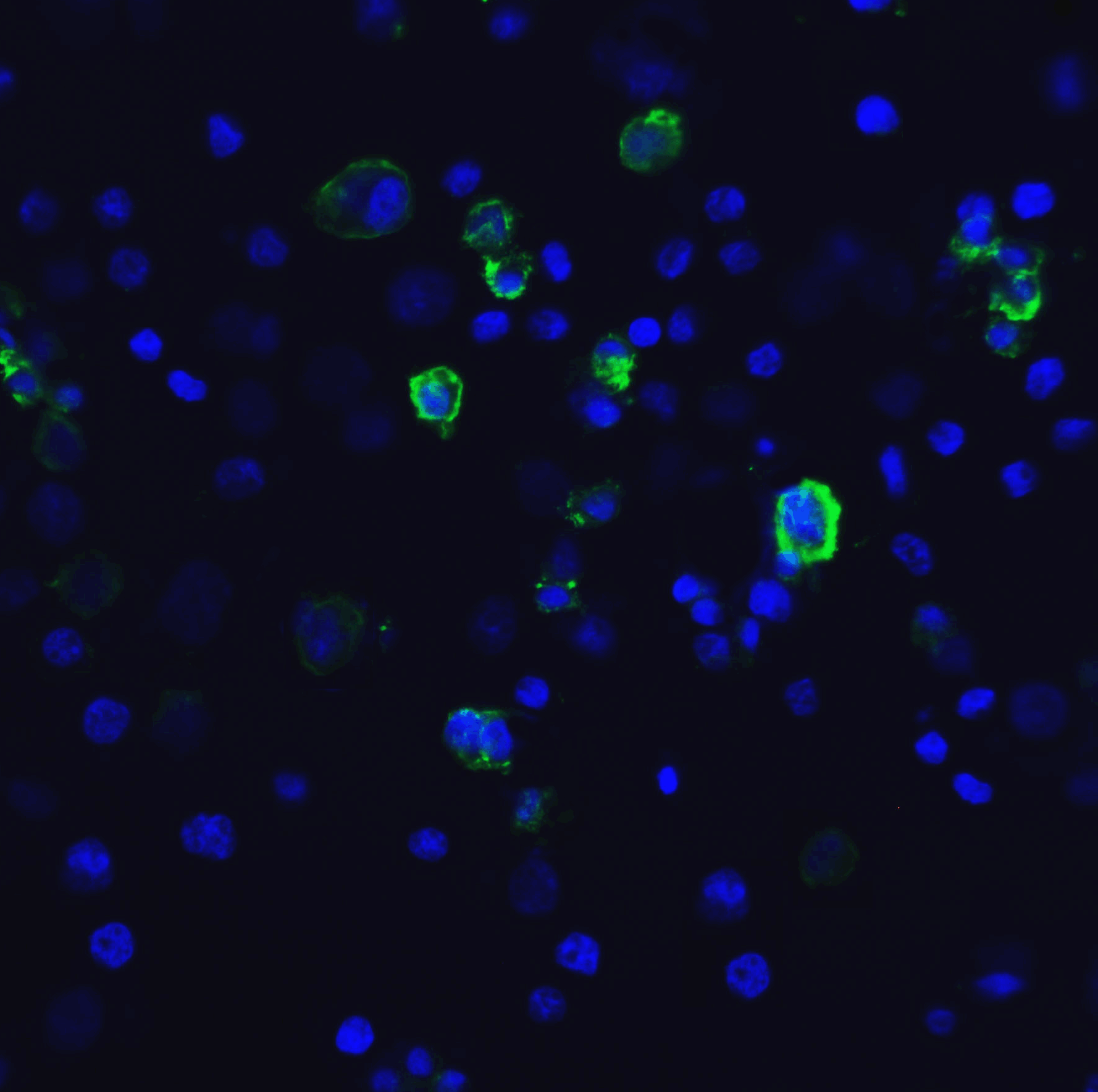 Monoclonal Mouse anti-Human HAVCR2 / TIM-3 Antibody (clone 1B10, IHC, IF, WB)
