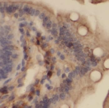 VDAC1 / PORIN Antibody