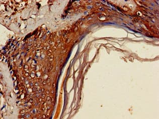 Polyclonal Rabbit anti-Human KDM4D / JMJD2D Antibody (IHC, IF)