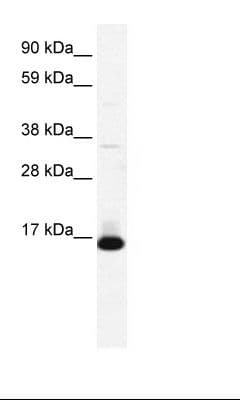 TCF21 / Epicardin Antibody (aa42-91)