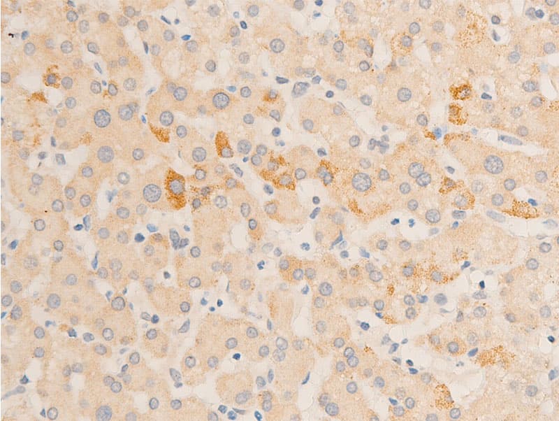 RELA / NFKB p65 Antibody (phospho-Ser536)