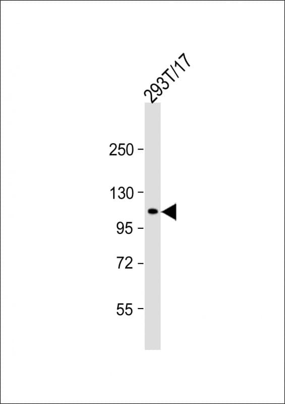 ECT2 Antibody (clone 1691CT516.3.3)