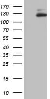 ZEB1 / AREB6 Antibody (aa1-350, clone OTI5B8, Carrier-free)