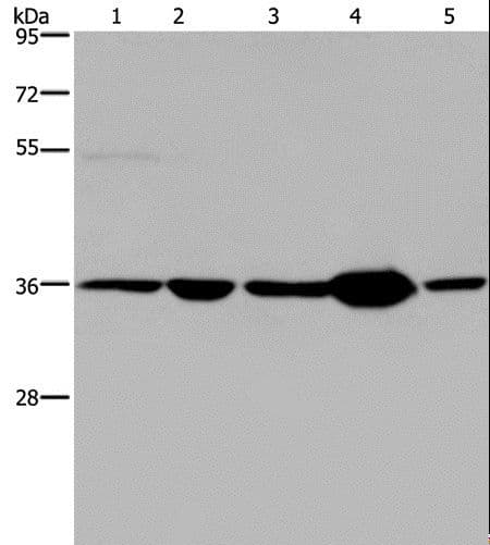 LZTFL1 Antibody