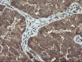 DOK7 Antibody (clone OTI1F7)
