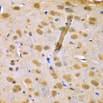RUFY1 Antibody
