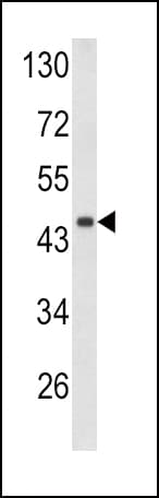 Polyclonal Rabbit anti-Human DCN / Decorin Antibody (aa122-150, IHC, WB)
