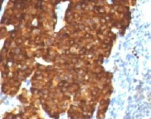 CHGA / Chromogranin A Antibody (clone bGRAN9, Ready-to-Use)