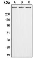 ADGRG4 / GPR112 Antibody (Internal)