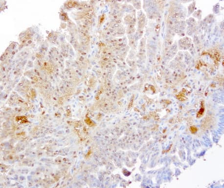 TP / Thymidine Phosphorylase Antibody (aa311-482, clone UMAB97)