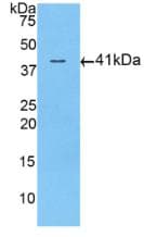 ACVR2 / ACVR2A Antibody (aa20-135)