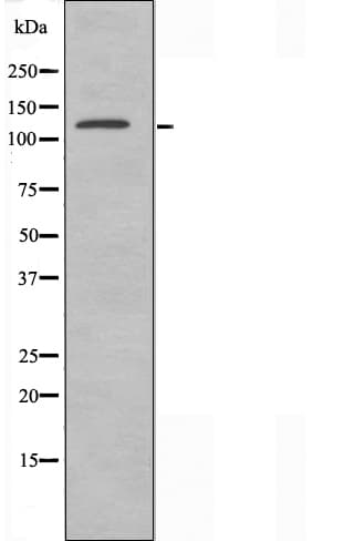ERCC5 / XPG Antibody