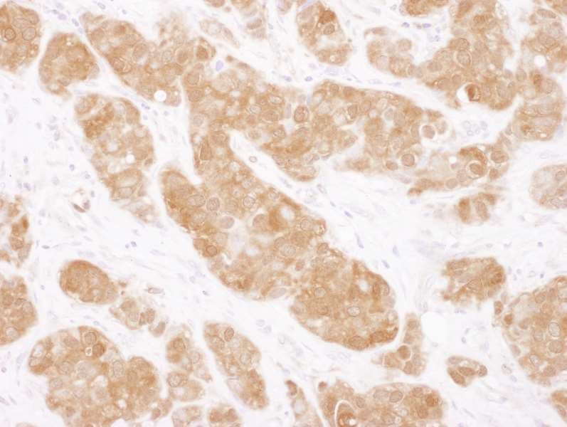 COMT Antibody (aa221-271)