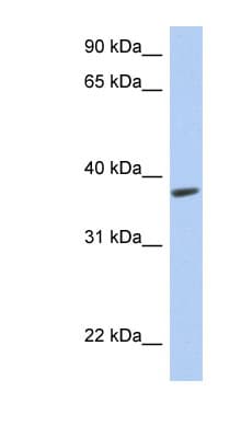 RSPH14 / RTDR1 Antibody (C-Terminus)