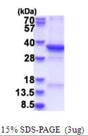 Human TSFM Protein (Recombinant)