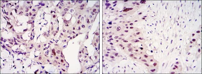 STAT3 Antibody (clone 3B5)